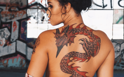 What To Expect During A Laser Tattoo Removal