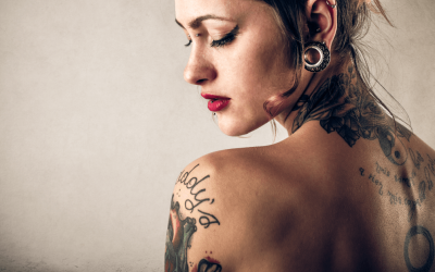 Top 5 Things You Should Know About Removing A Large Tattoo