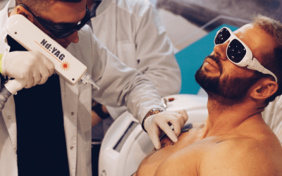 What should you know about laser tattoo removal?