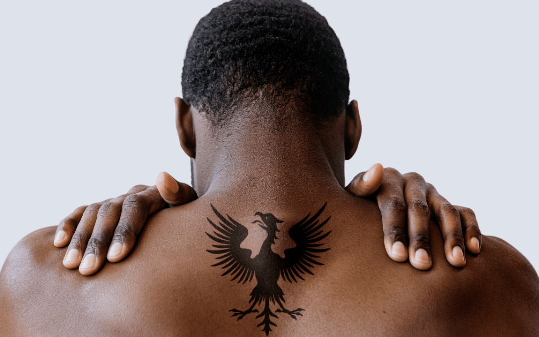 Understanding the Complexities of Tattoo Removal on Dark Skin