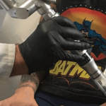 Large Tattoo Removal