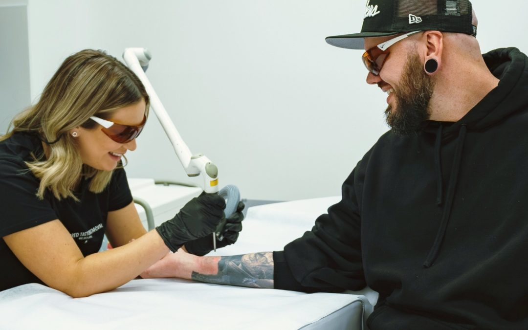 The Ultimate Guide to Laser Tattoo Removal: What You Need to Know