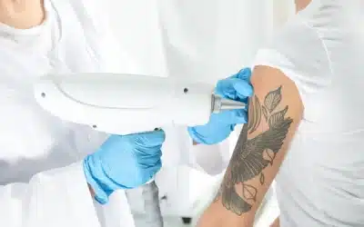 Finding the Best Tattoo Shops Near Me and Understanding Laser Tattoo Removal