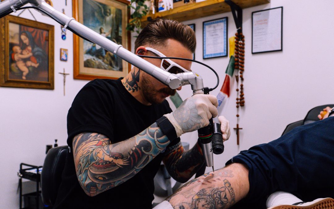 Blue Ink Tattoo Removal