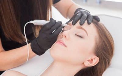 Acne Scar Removal Orlando