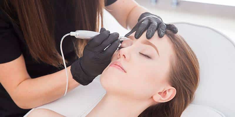 Acne Scar Removal Orlando