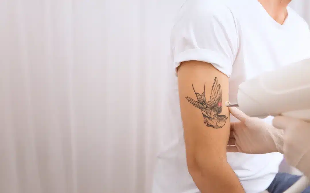 How to Fade Tattoos with Cream