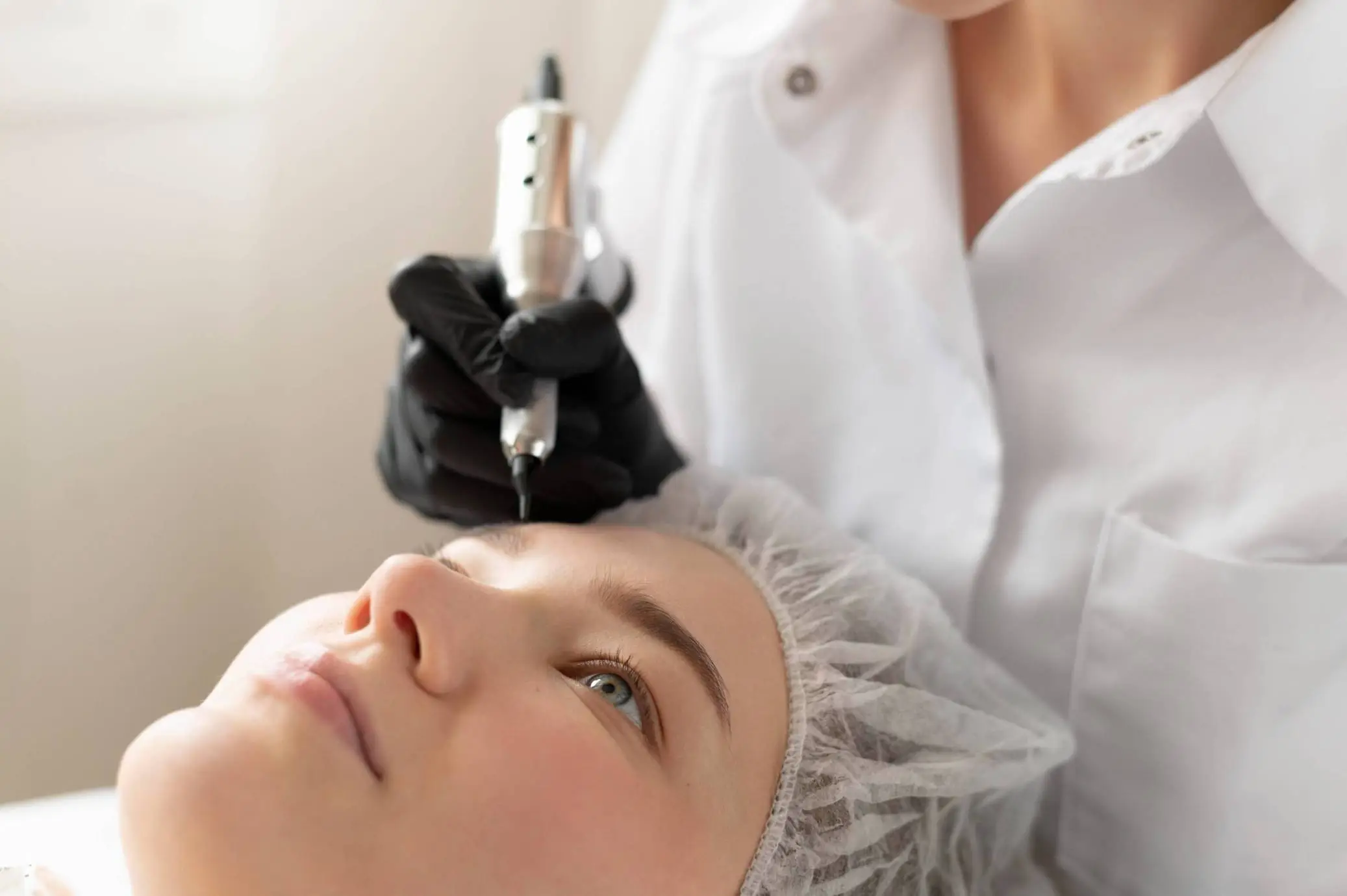 Acne Scar Removal Orlando