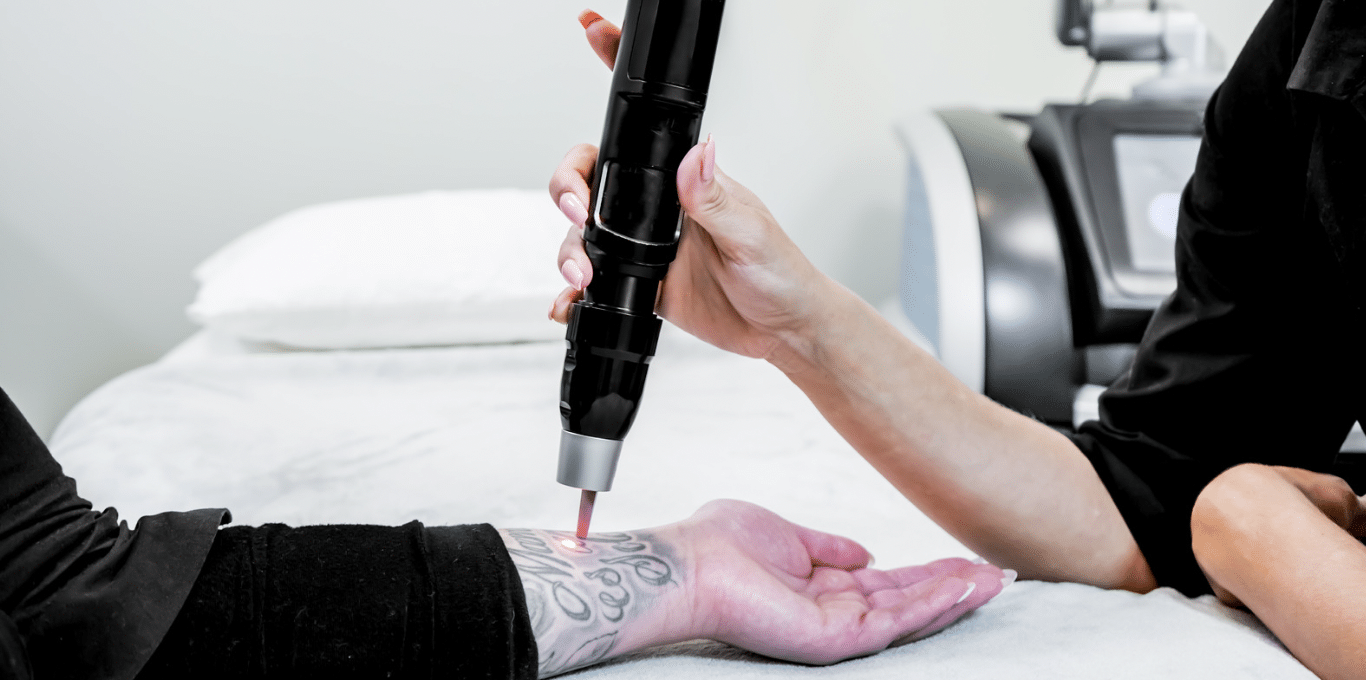 Top Tattoo Removal Laser Machines