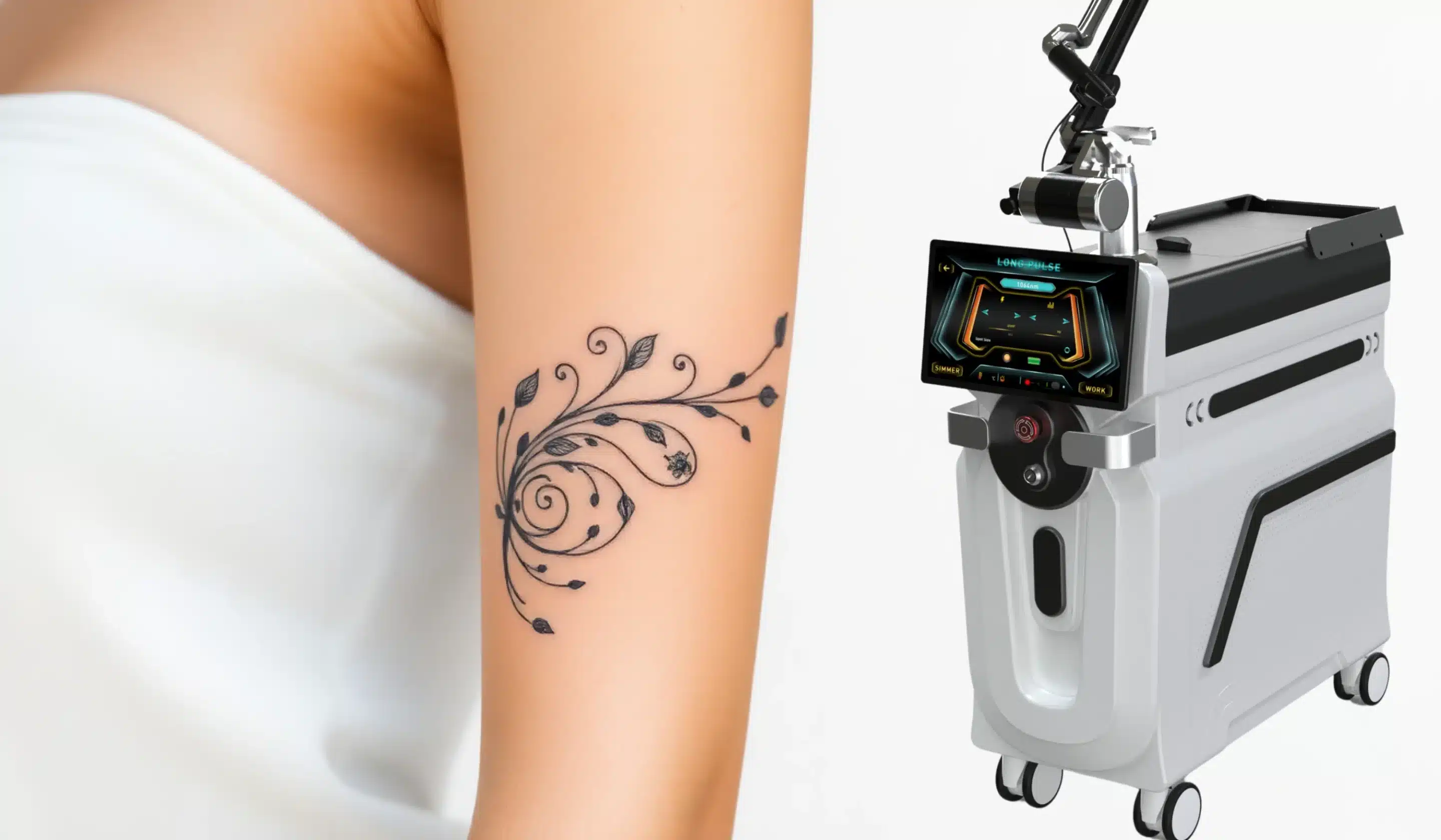 New Laser Tattoo Removal Technology