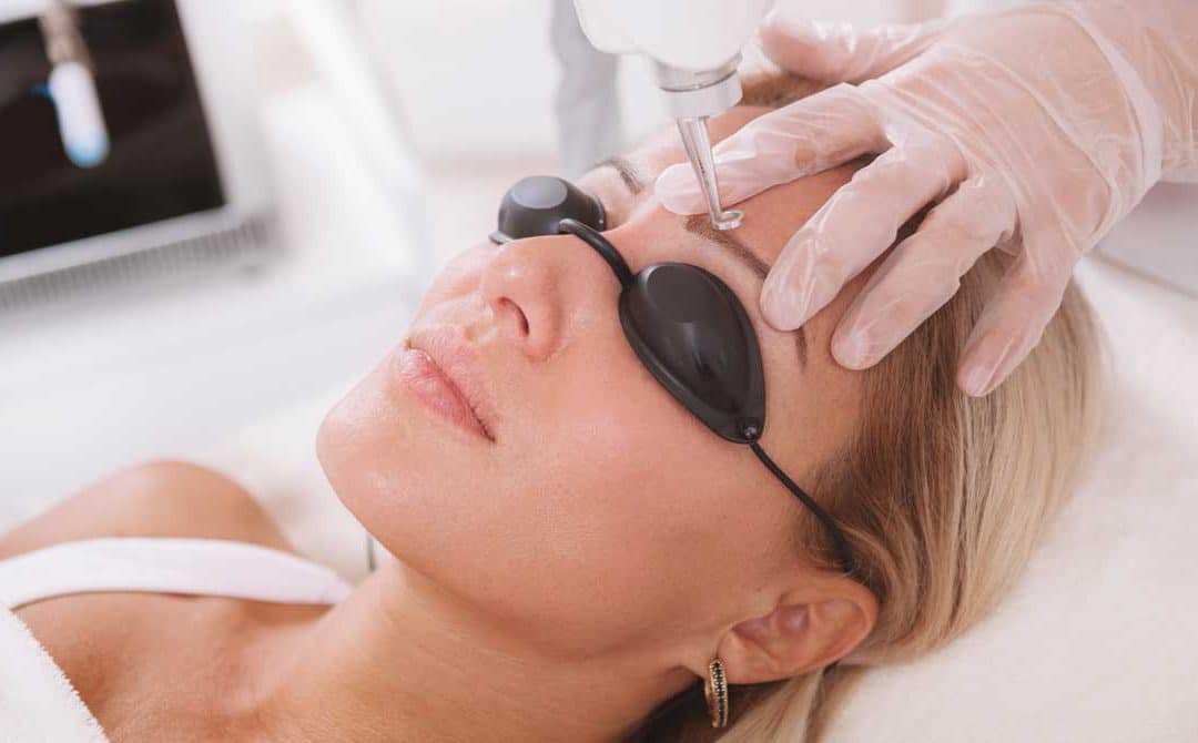 cosmetic tattoo removal