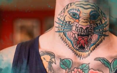 Laser Tattoo Removal by Color: Challenges, Solutions & Results