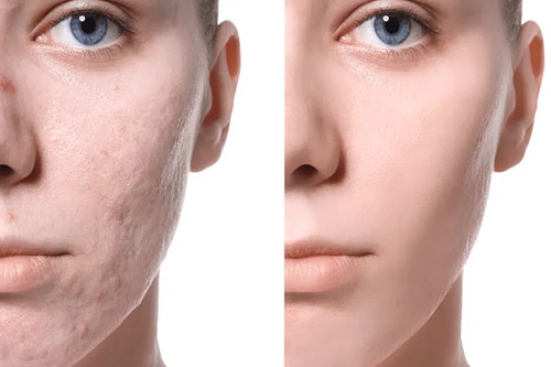 skin repairs