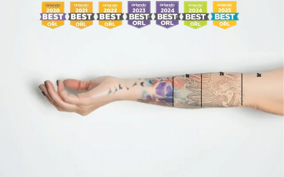 Best Tattoo Removal in Winter Park for 7 Years