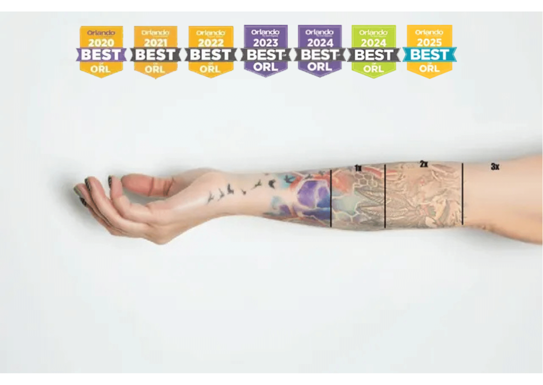 Best Tattoo Removal in Winter Park for 7 Years