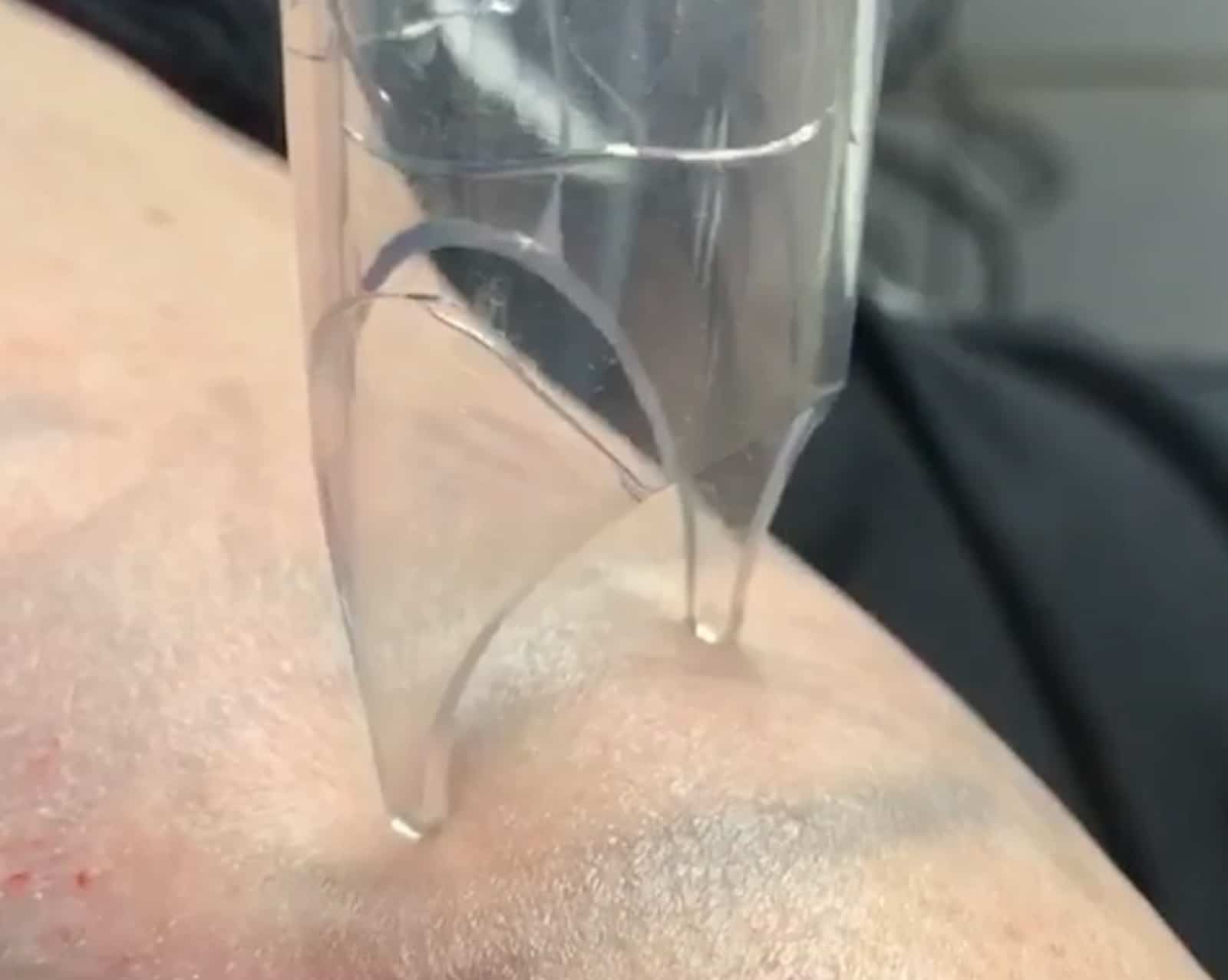latest laser technology