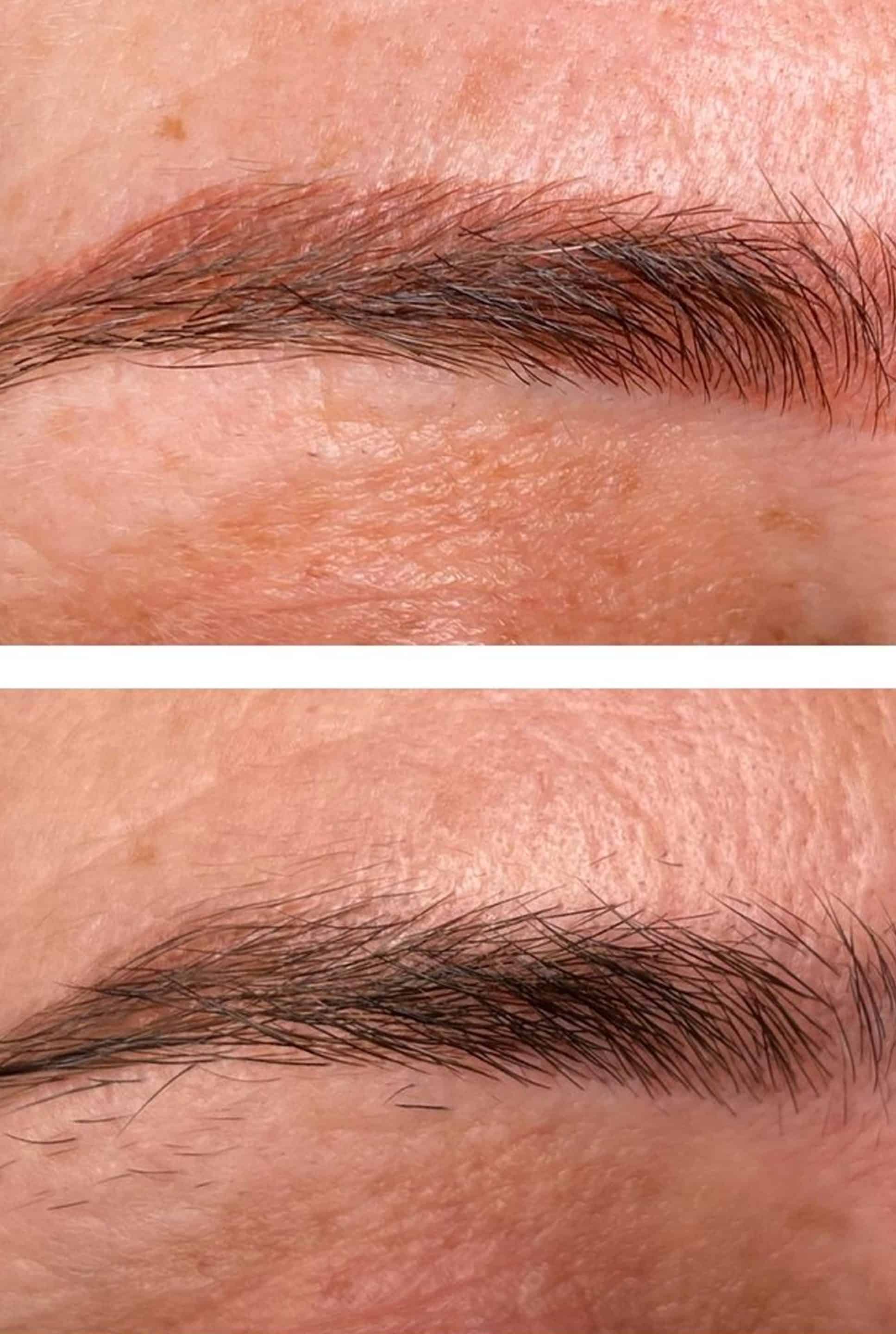 Microblading