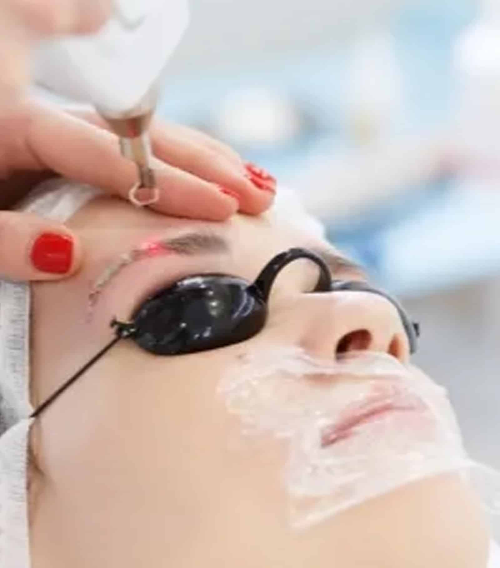 Winter Park Tattoo Removal