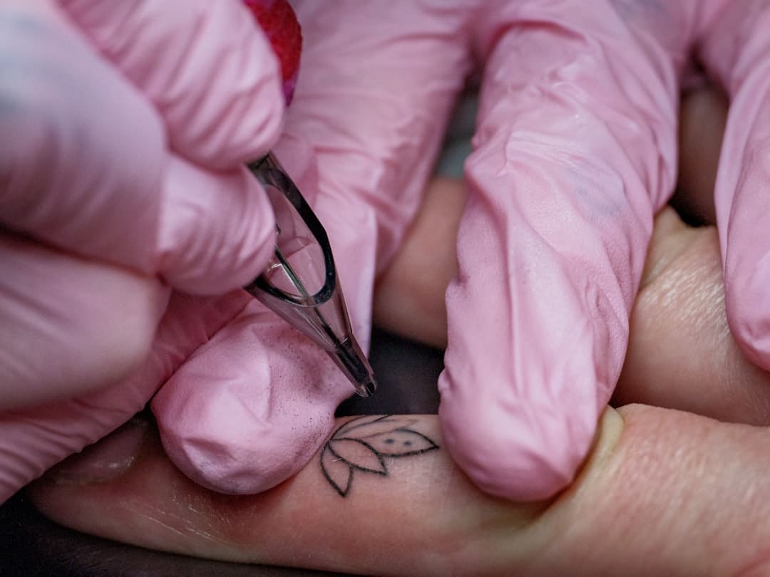 Best Tattoo Removal Technology