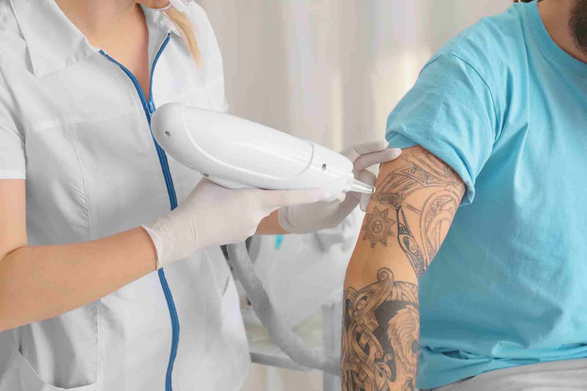 Best Tattoo Removal Technology