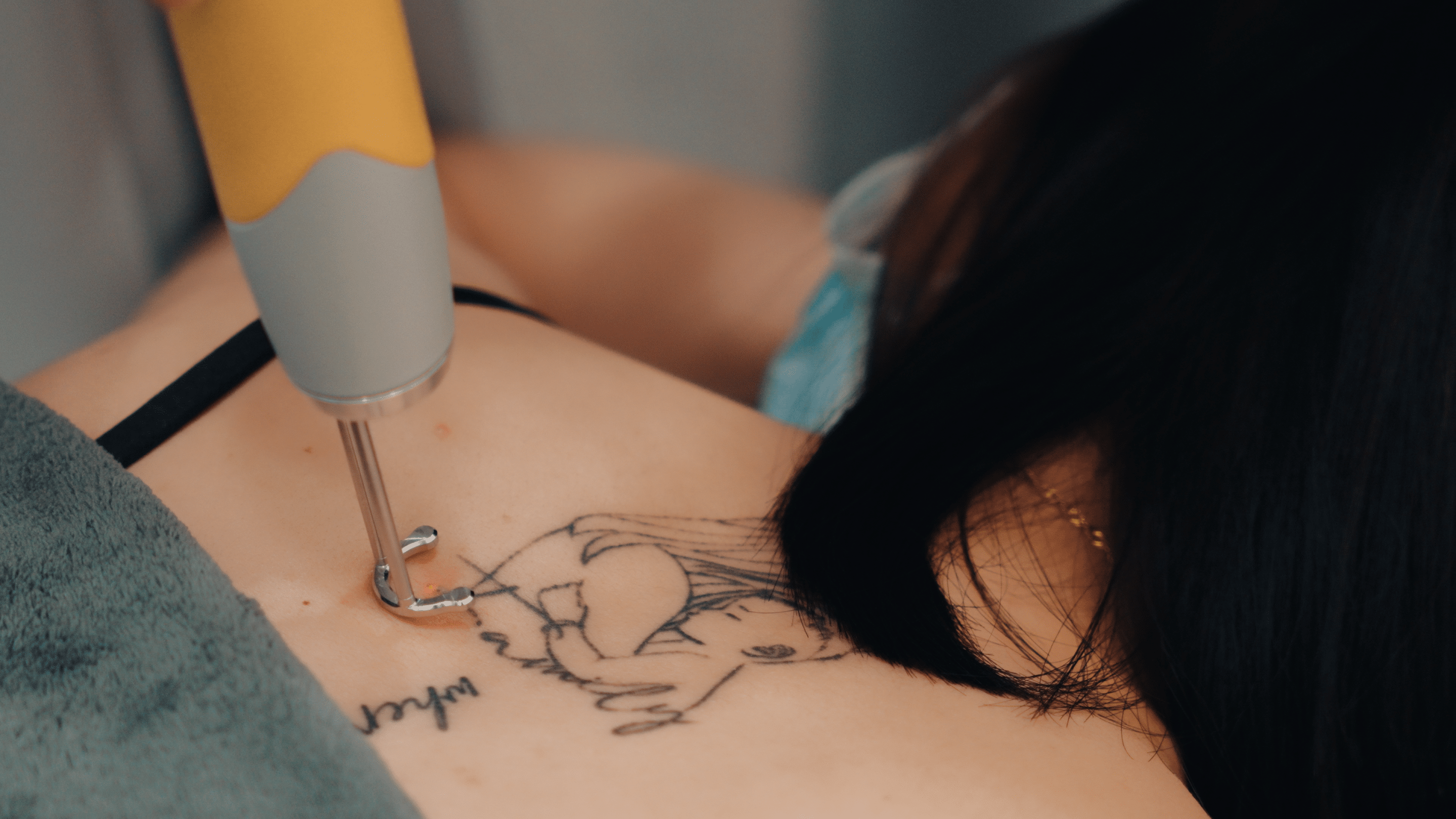 Does Pico Laser Work for Cover-Up Tattoos