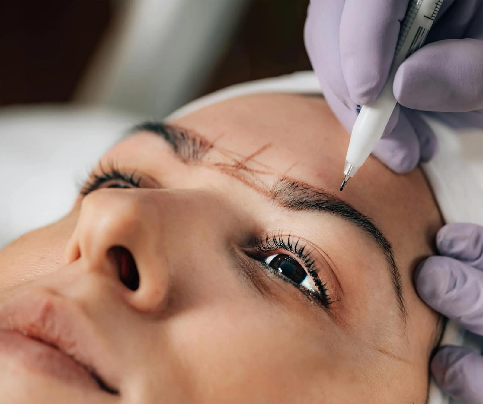 Microblading Removal with Pico Laser
