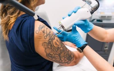 Pain-Free Tattoo Removal in Orlando: Numbing Solutions for Maximum Comfort