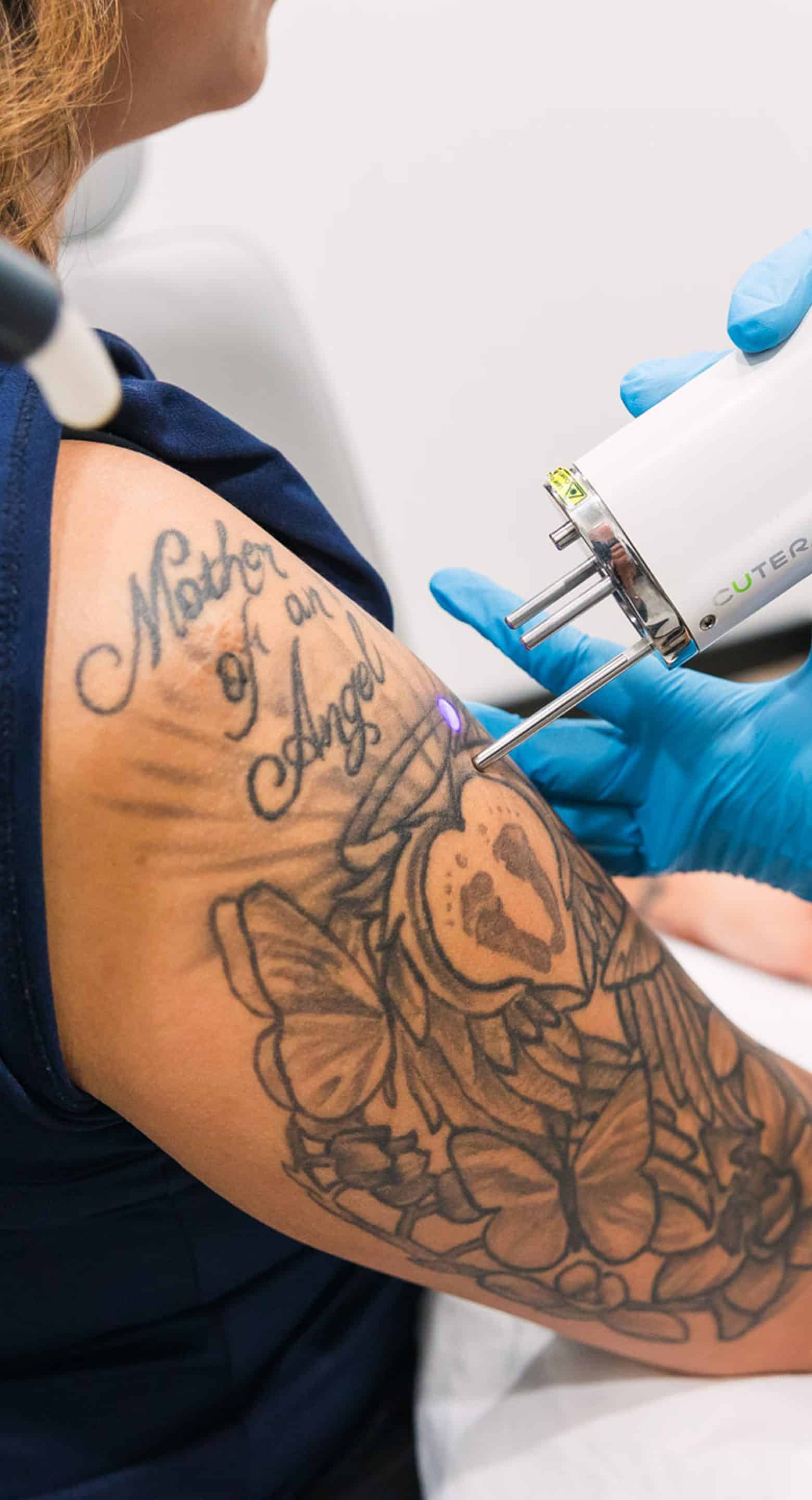 Post-Treatment Tips After Using BLT