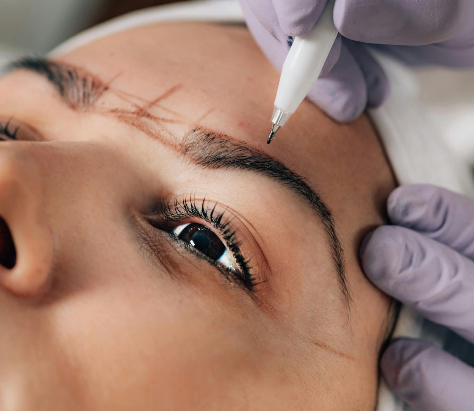 Real-Life Results and Celebrity Cases