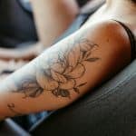 Tattoo Removal After Pictures