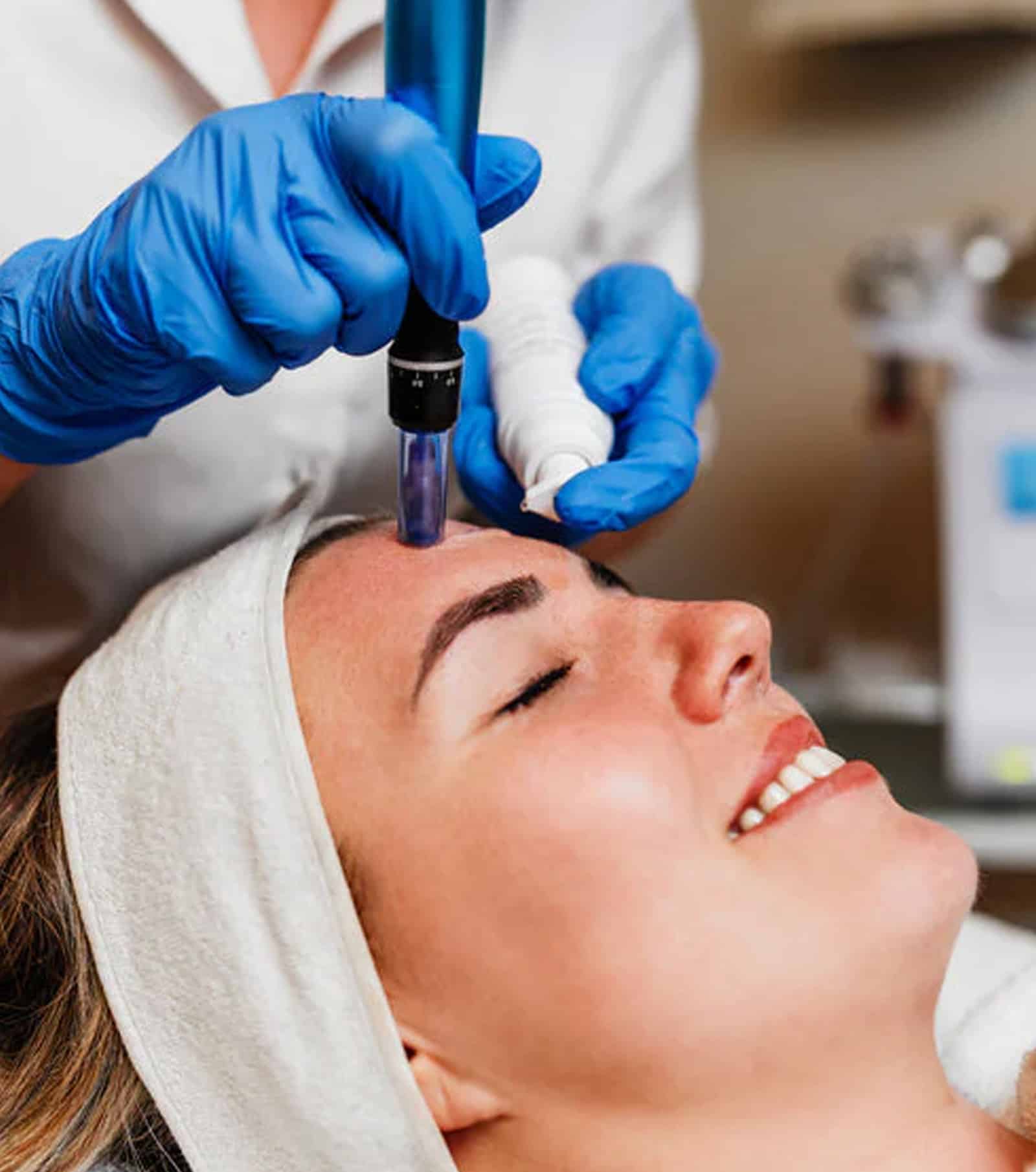 Happens During an Acne Scar Treatment Plan