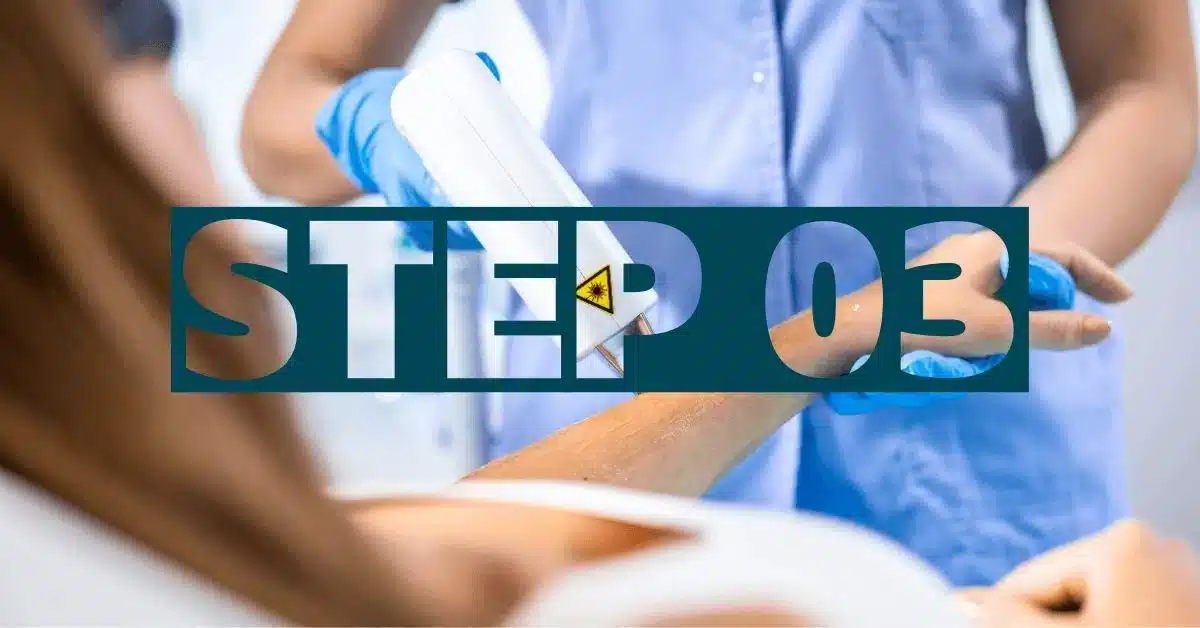 STEP-012.jpg Tattoo Removal Sessions