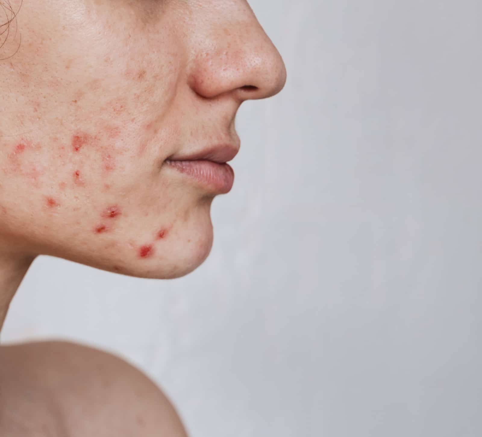 Clients Trust Winter Park Tattoo Removal
