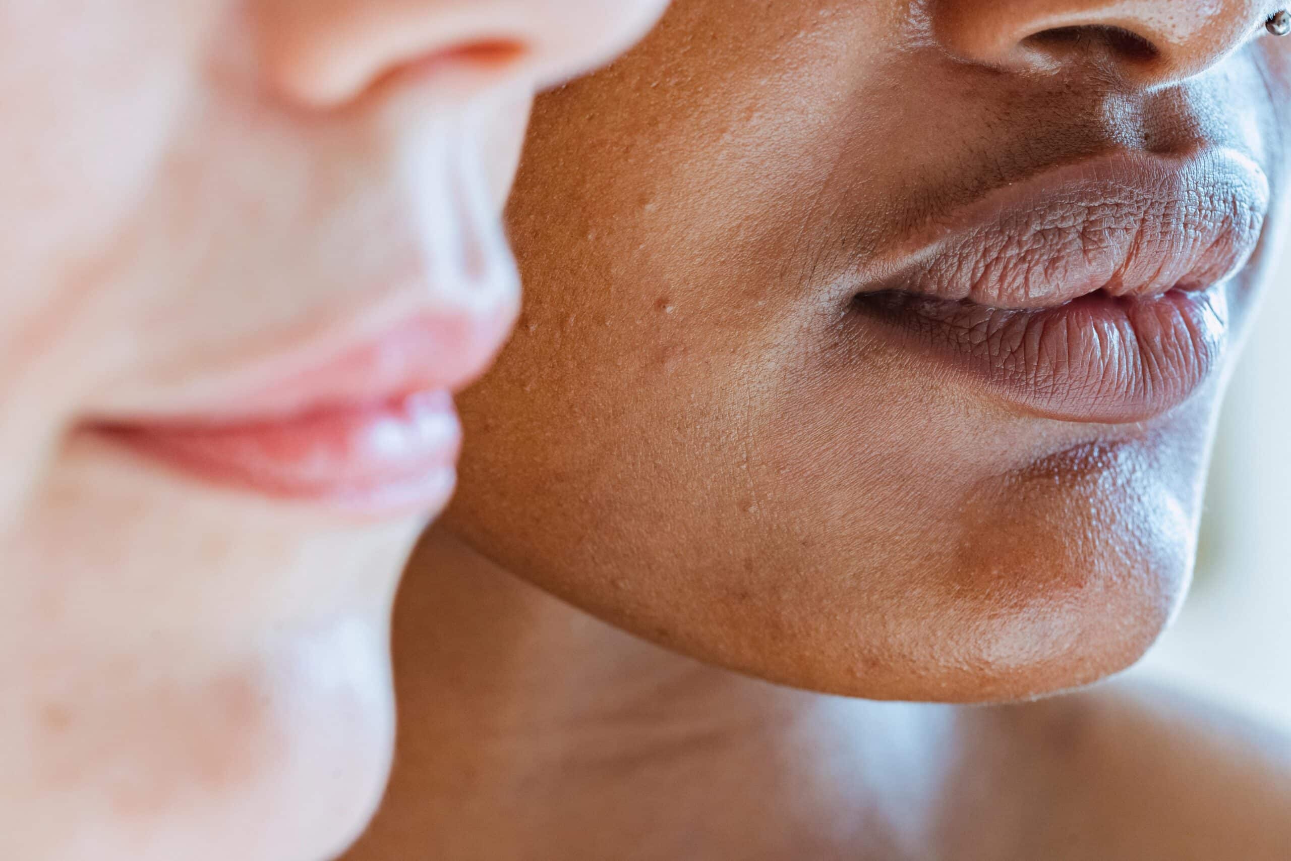 tattoo removal dark skin orlando