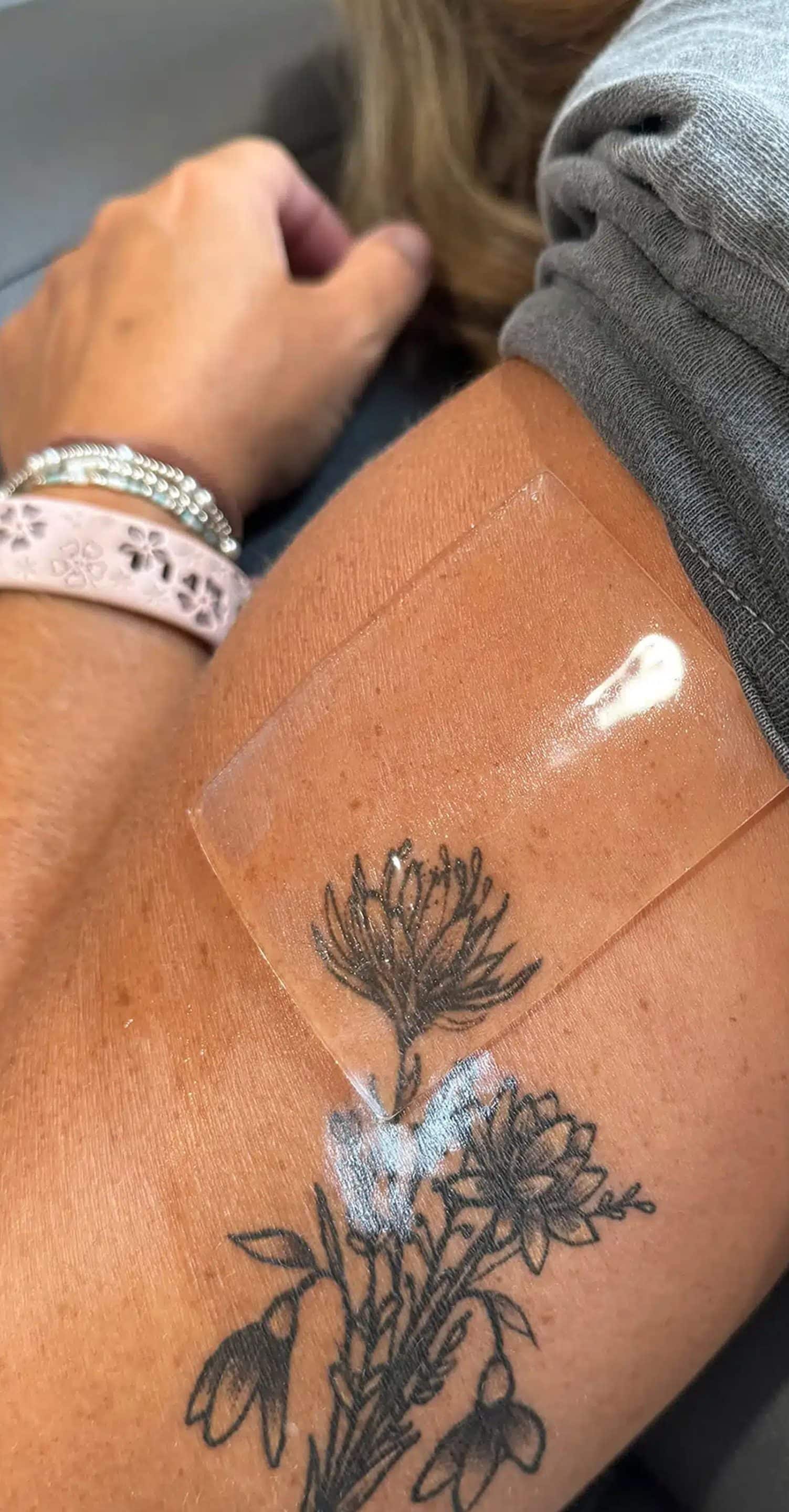 PFD Patch Tattoo Removal Safe