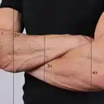 how many sessions does laser tattoo removal take?