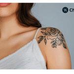 cherry pay tattoo removal