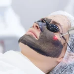 laser tattoo removal cost breakdown
