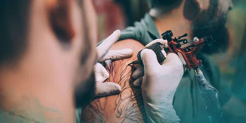 why local care wins: winter park tattoo removal vs removery