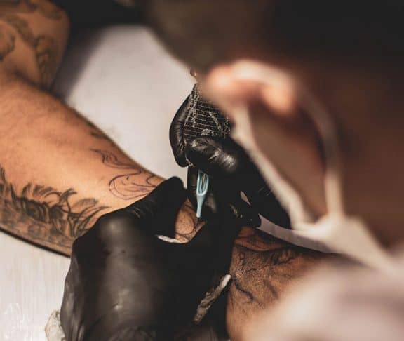 why local care wins: winter park tattoo removal vs removery
