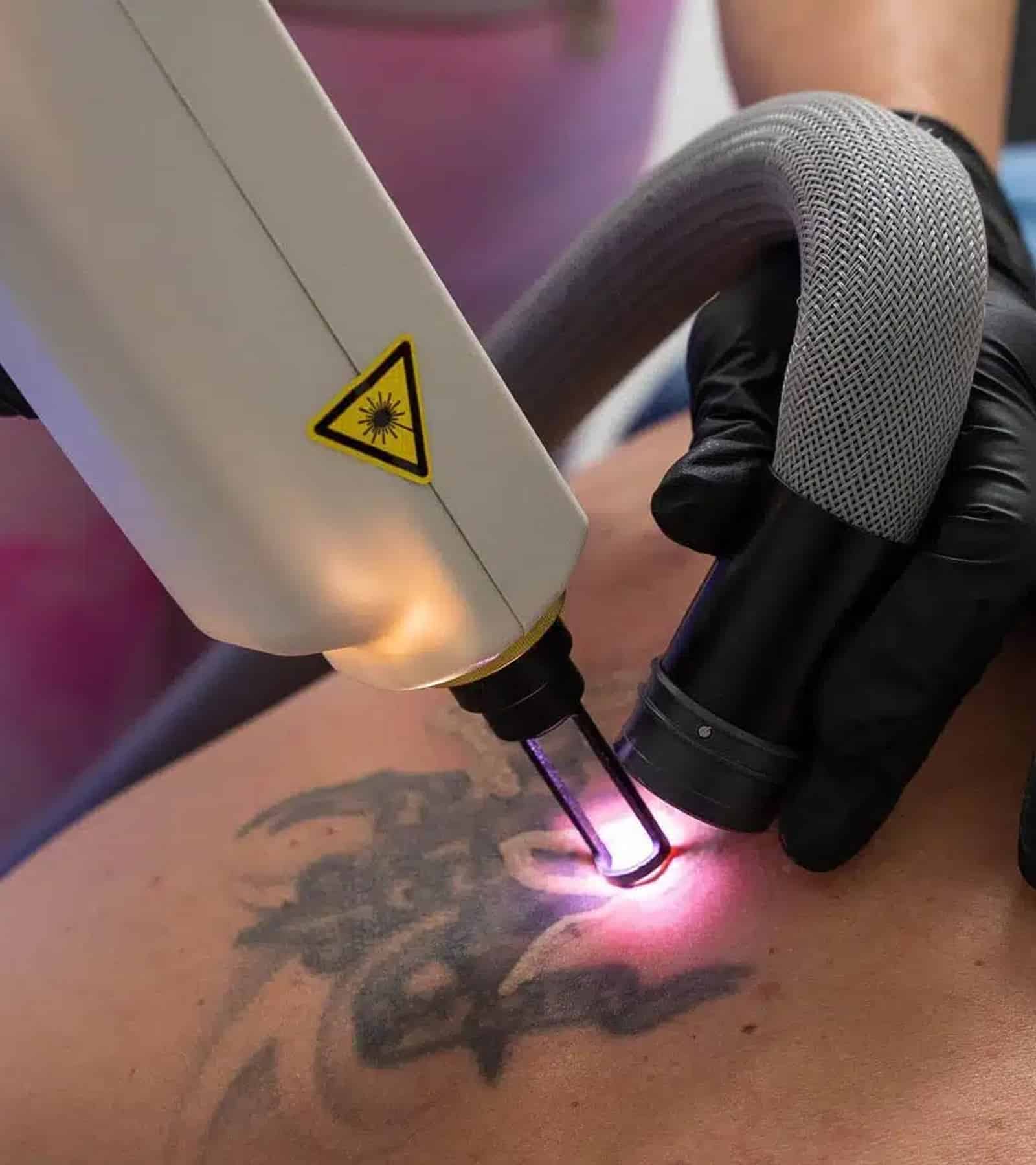Expert Laser