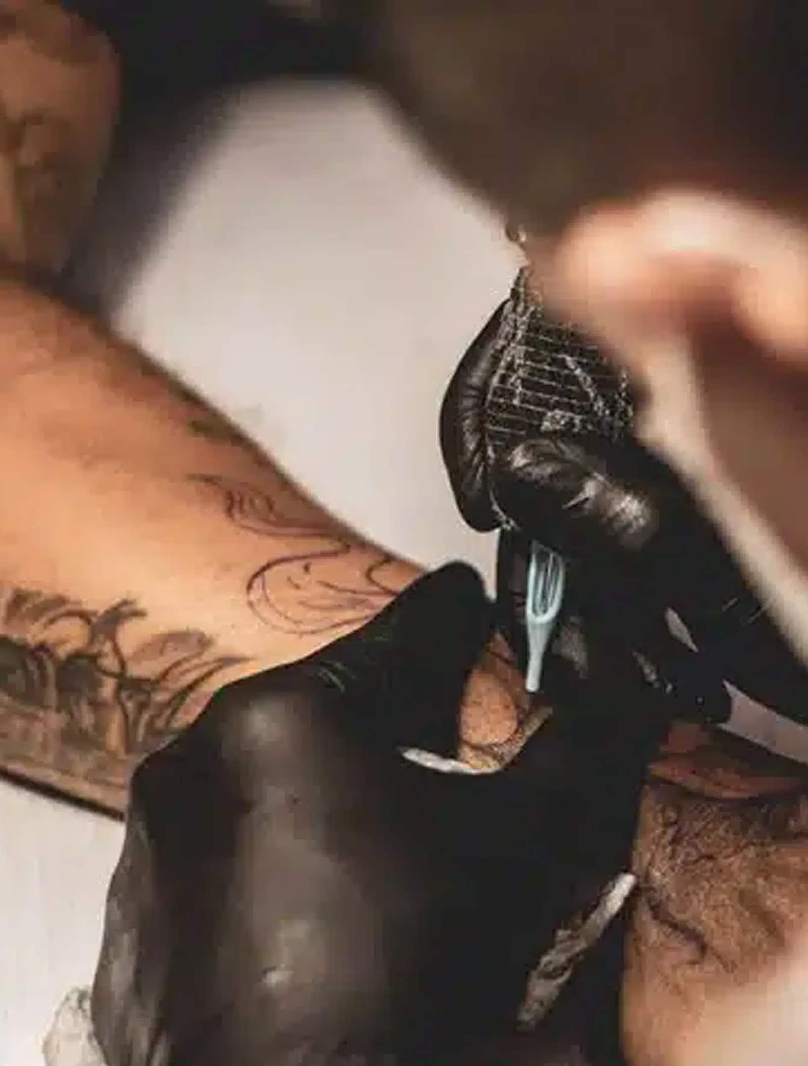 why local care wins: winter park tattoo removal vs removery