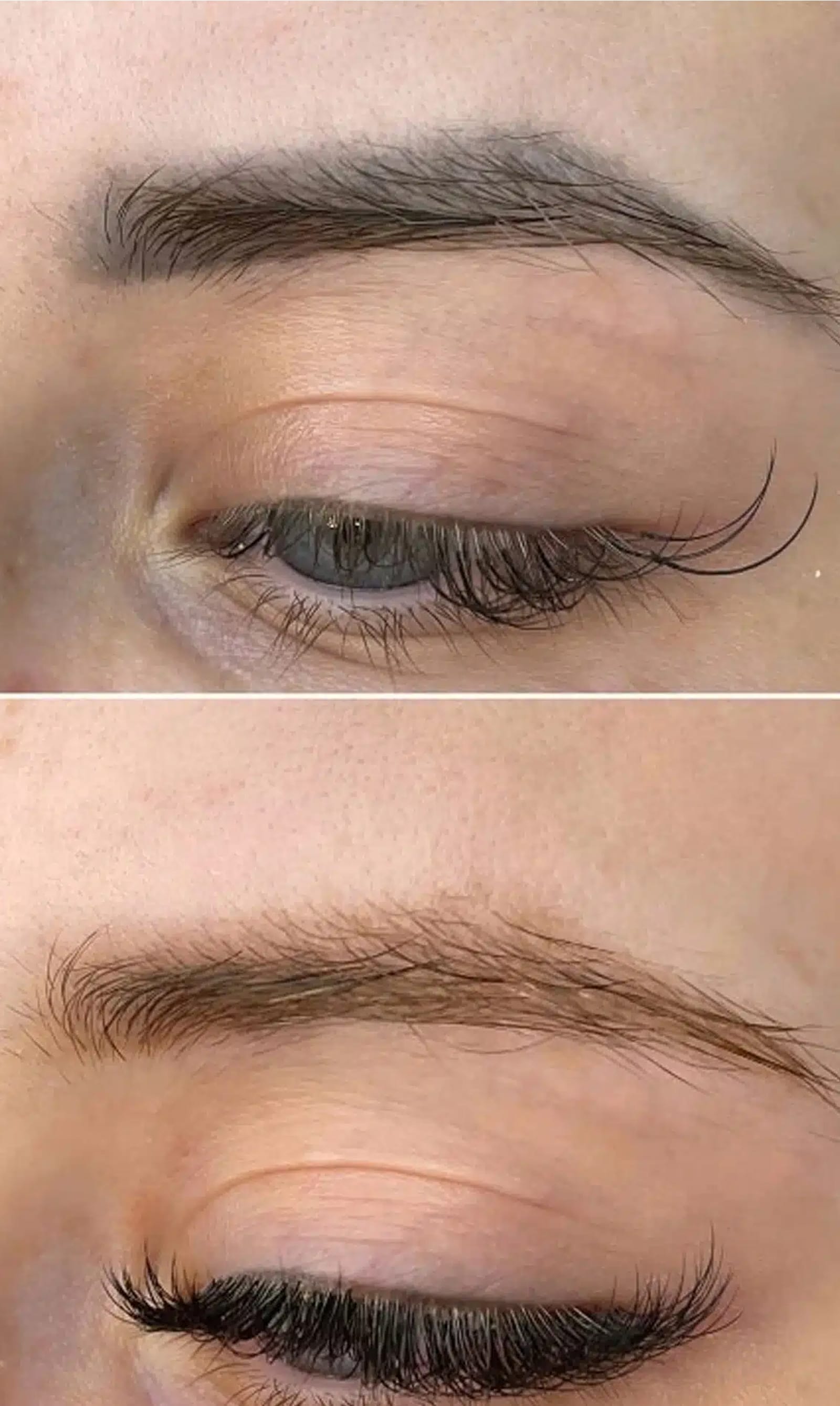 Winter Park Tattoo Removal