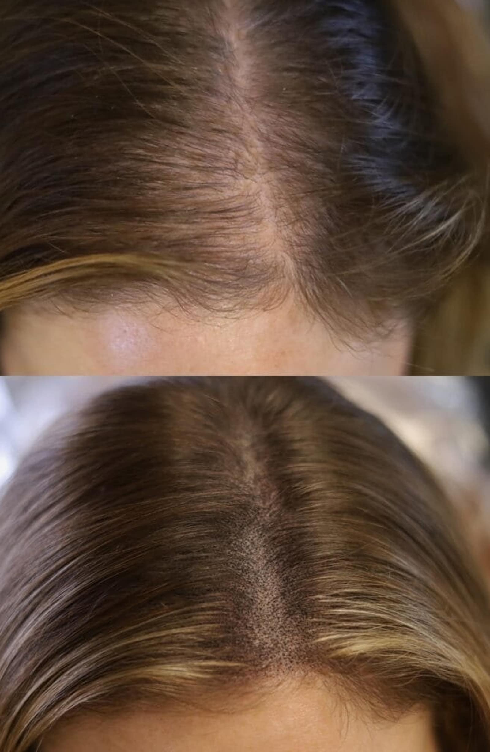 Consultation & Skin Assessment