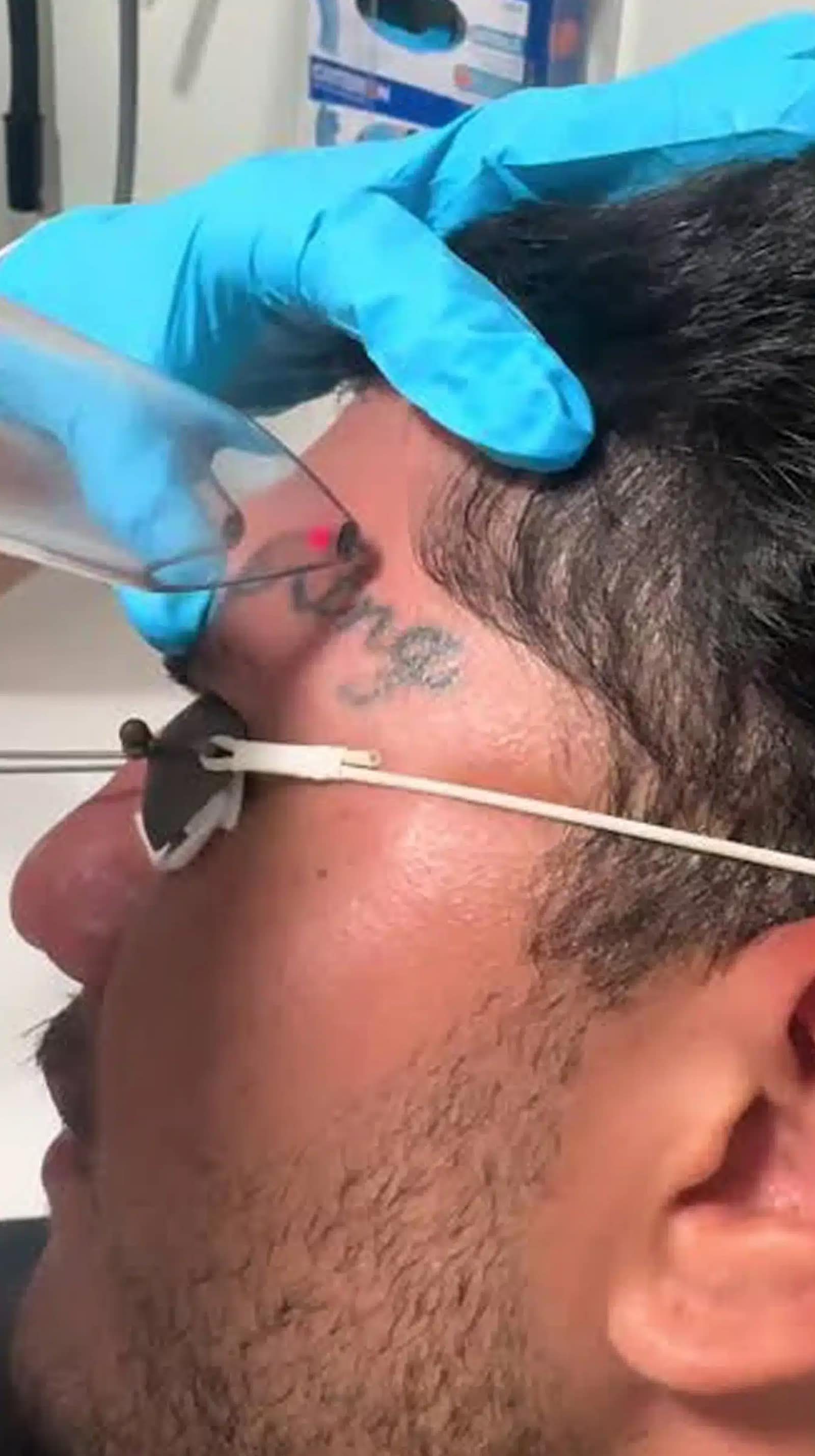 PFD Patch Laser Tattoo Removal
