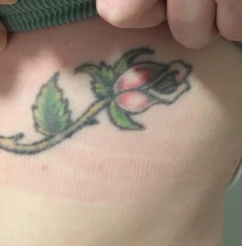 Tattoo before laser tattoo removal at Winter Park Tattoo Removal
