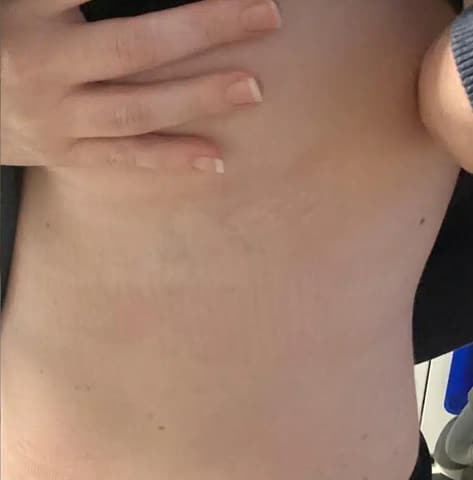 Tattoo after laser tattoo removal treatments at Winter Park Tattoo Removal
