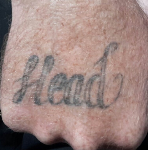 Tattoo before laser tattoo removal at Winter Park Tattoo Removal