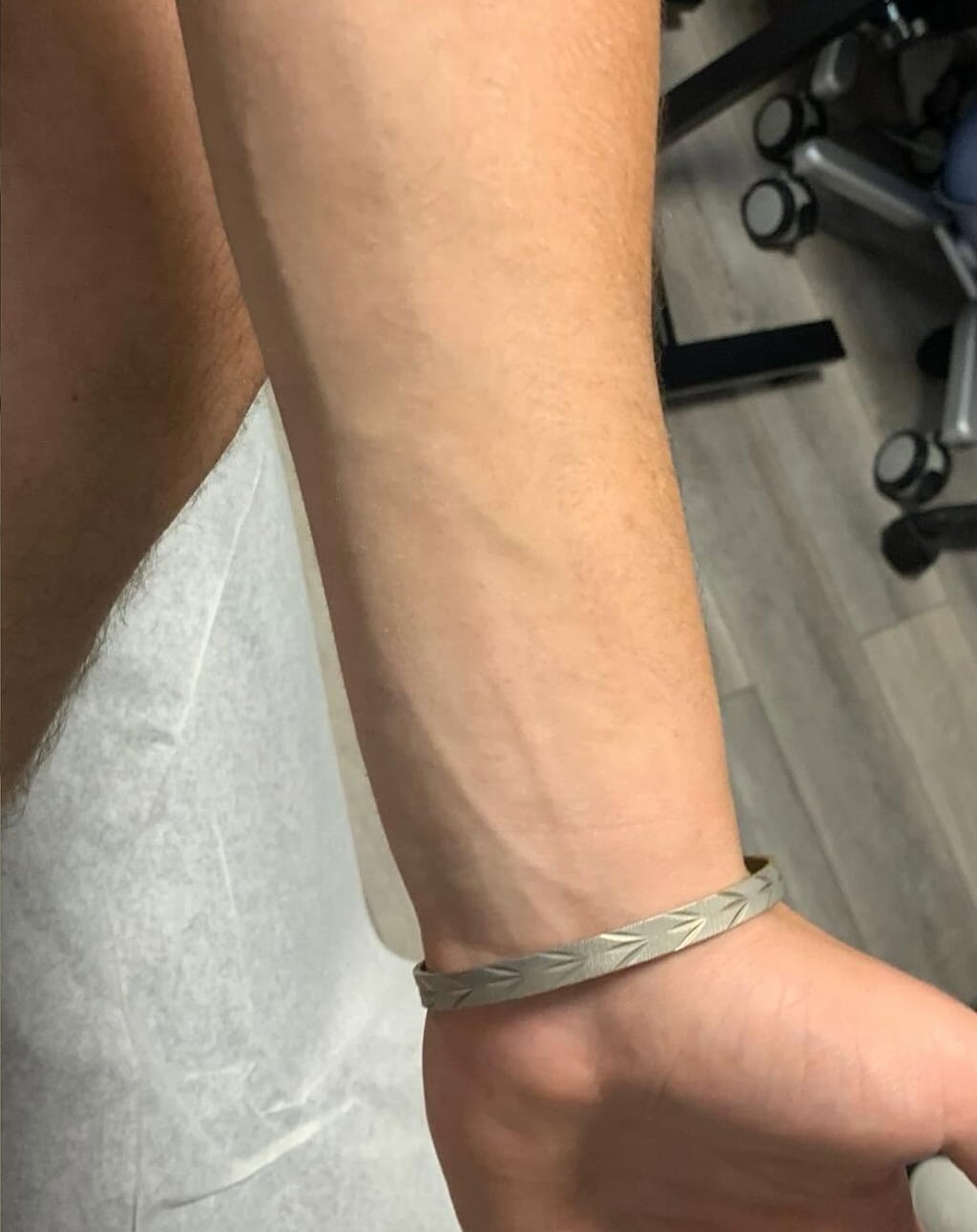 Skin after laser tattoo removal treatment