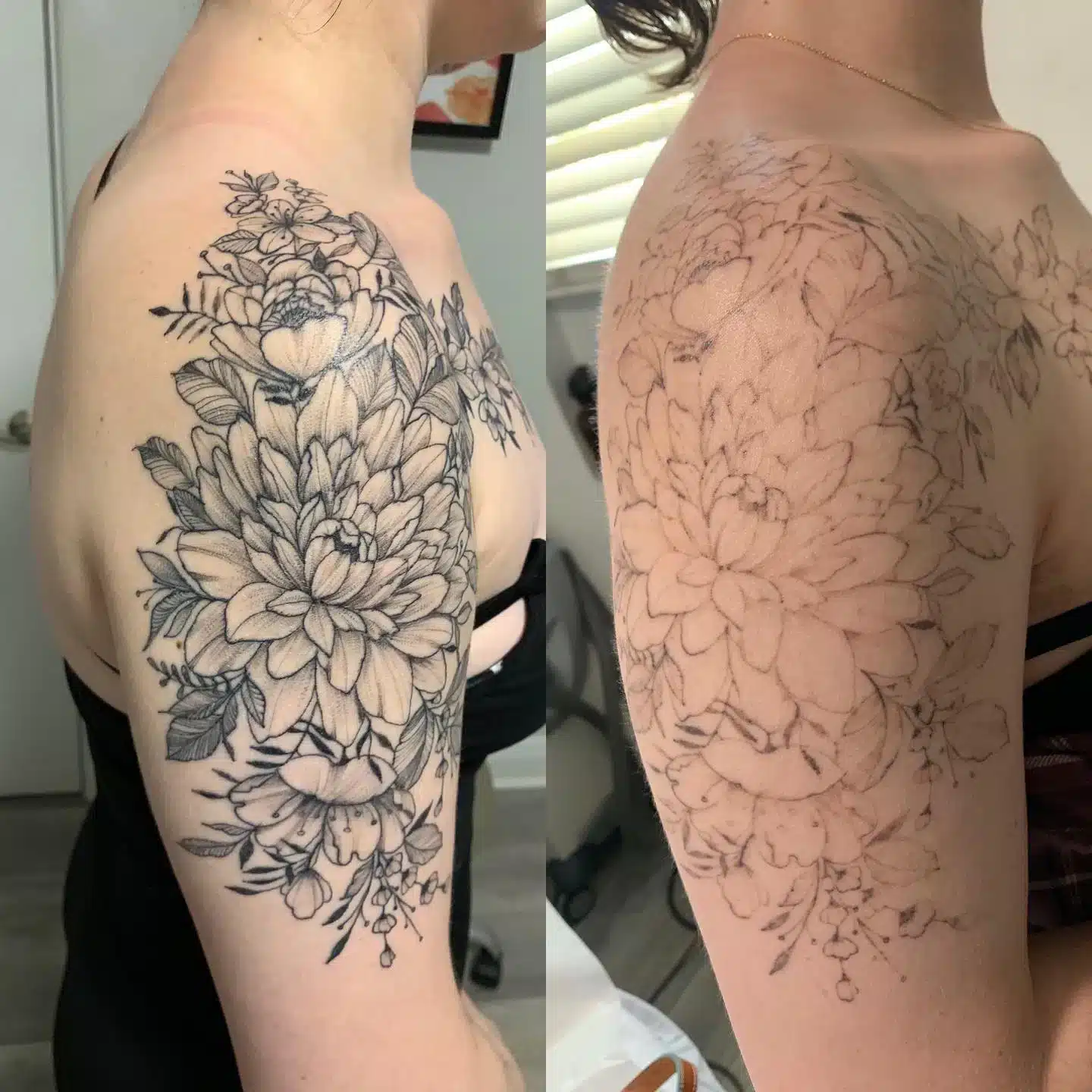 art tattoo removal technology Choose Winter Park